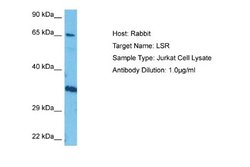 Lipolysis Stimulated Lipoprotein Receptor Rabbit anti-Human, Polyclonal,